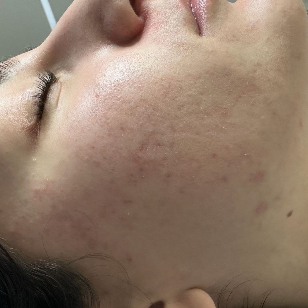 Aknefreie, saubere Haut einer netten Frau aus dem Süden mit schwarzen Haare